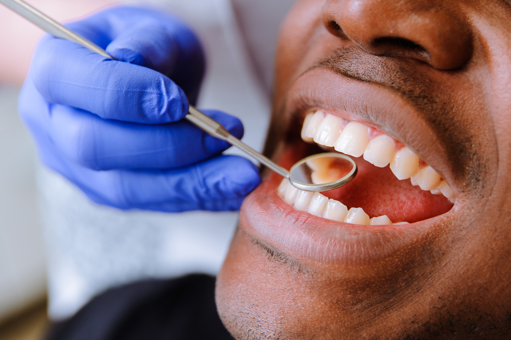 Who Qualifies For VA Dental Care