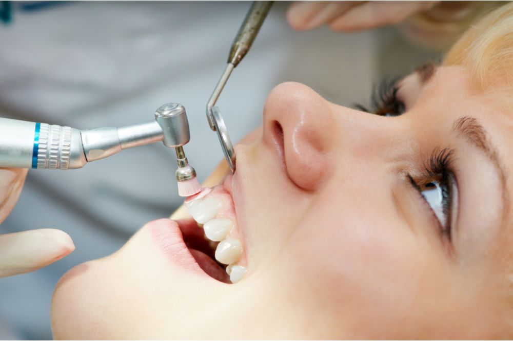 tooth Polishing