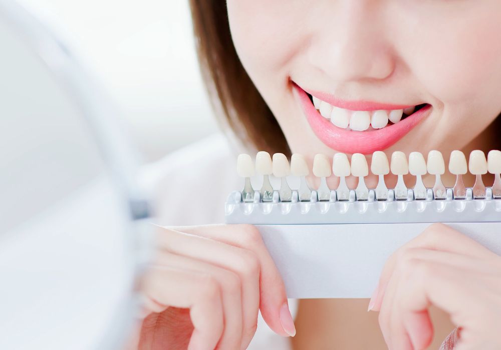 How Much Does Teeth Whitening Cost?