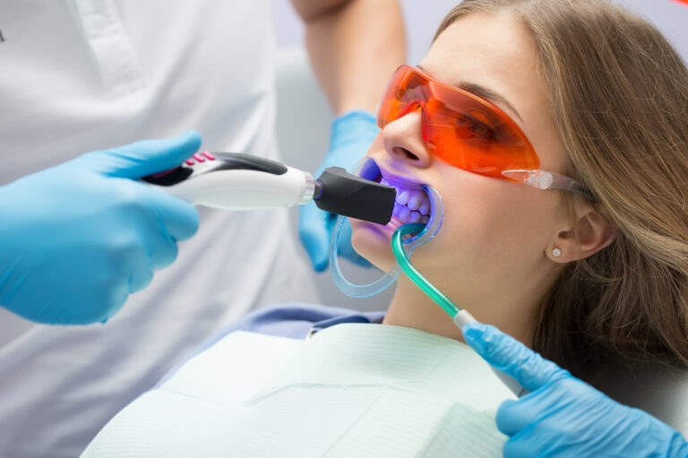 How Much Is Teeth Whitening At Dentist With Insurance?