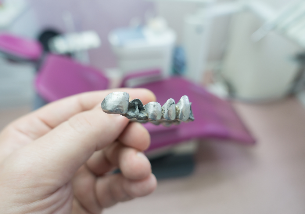 Supplementing Dental Insurance for Bridge Costs