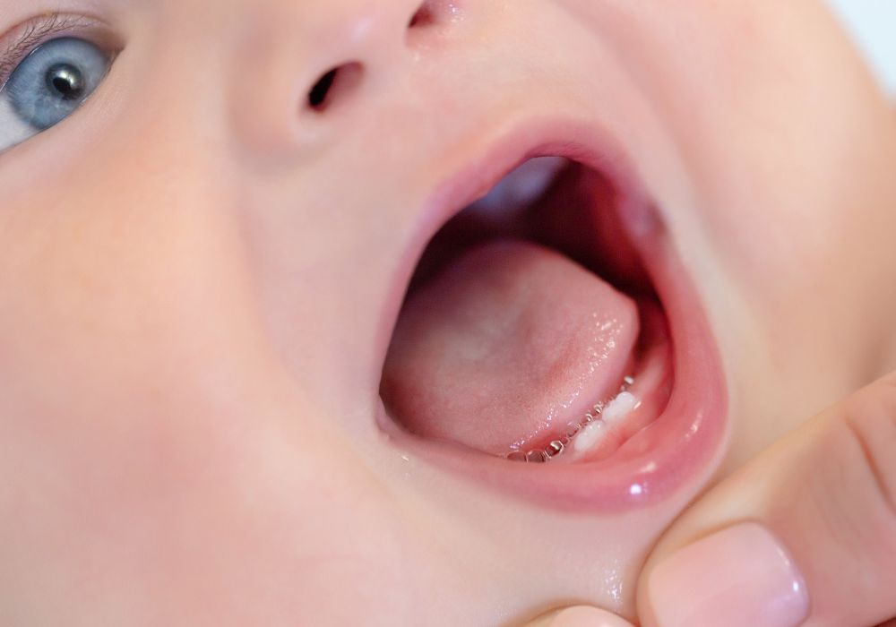 Teething relief tips and remedies